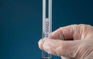 В "Артеку" – спалах коронавірусу