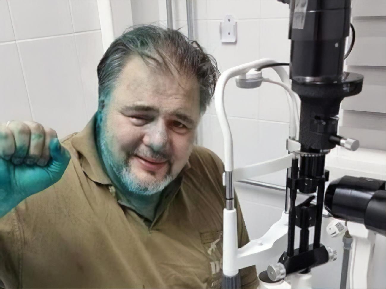 У Коцабы диагностировали химический ожог глаза