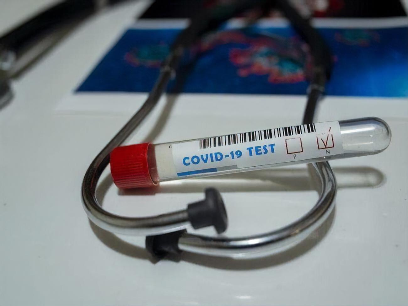 Упродовж доби у країні зробили 19 тис. тестів на коронавірус