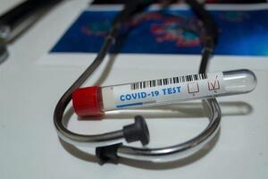 Упродовж доби у країні зробили 19 тис. тестів на коронавірус