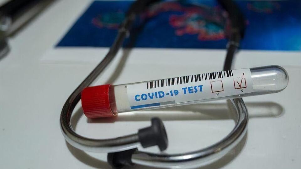 Упродовж доби у країні зробили 19 тис. тестів на коронавірус