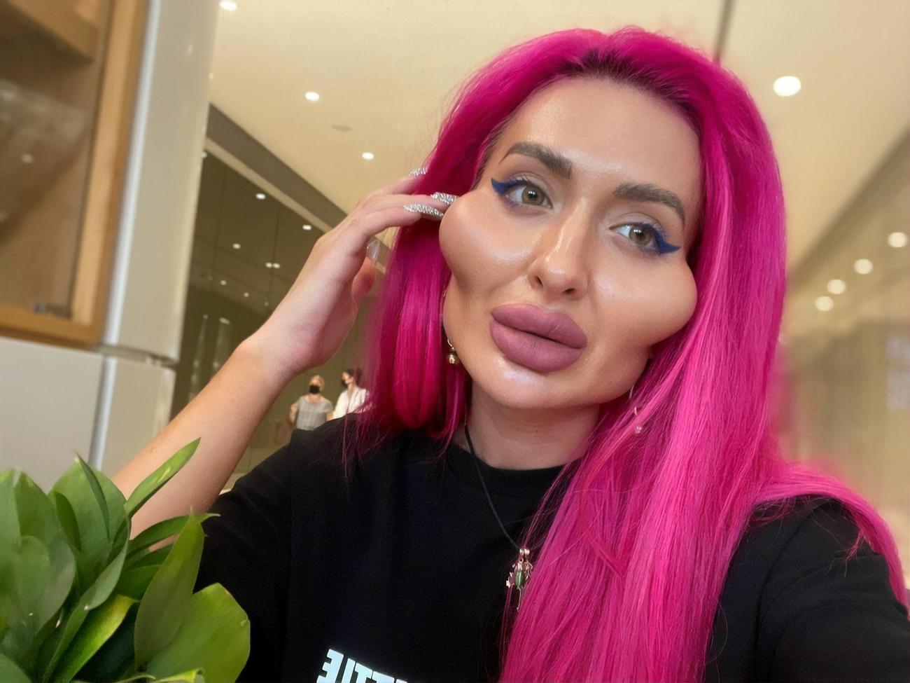 Покрещук весной 2021 года сделала липосакцию