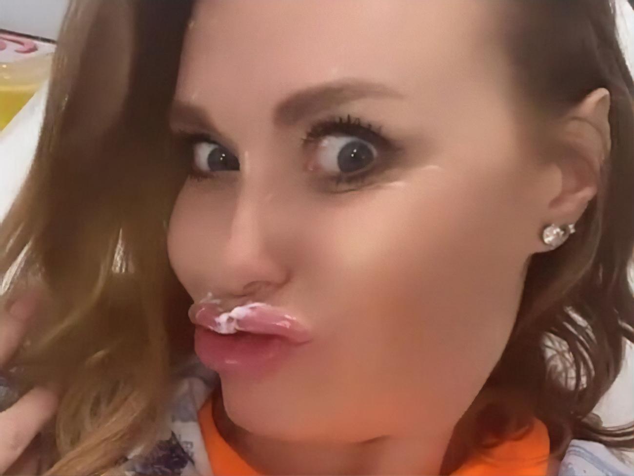 Каминская начала "наводить красоту" с уколов в губы