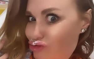 Камінська почала "наводити красу" з уколів у губи