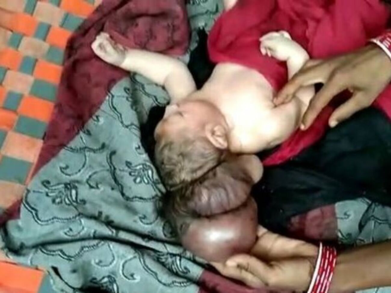 Новорожденный чувствует себя хорошо