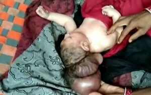 Новорожденный чувствует себя хорошо