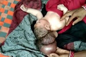 Новонароджений почувається добре