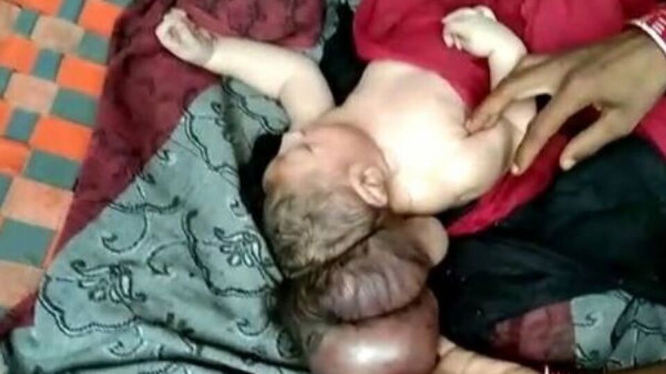 Новонароджений почувається добре