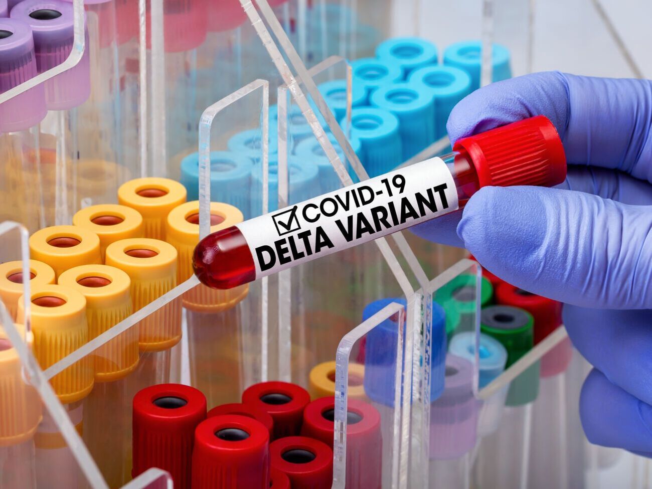 По данным ВОЗ,&nbsp;штамм "Дельта" зарегистрировали в 98 странах