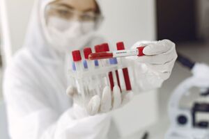 26 серпня в Україні зробили понад 53 тис. тестів на COVID-19