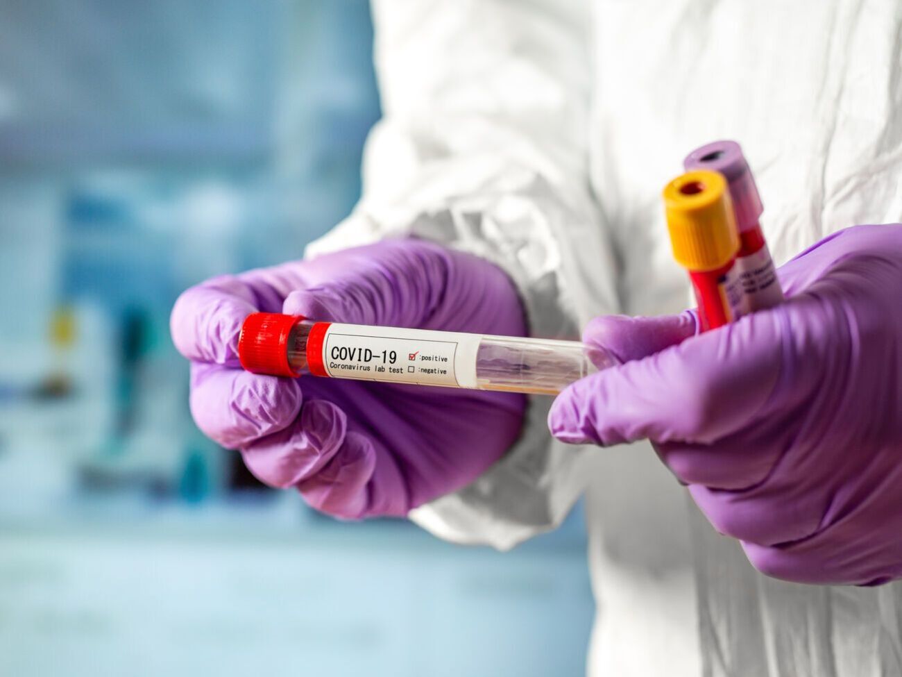 За минувшие сутки в Украине подтвердили 827 новых случаев коронавирусной инфекции