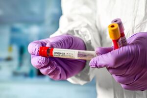 За минувшие сутки в Украине подтвердили 827 новых случаев коронавирусной инфекции