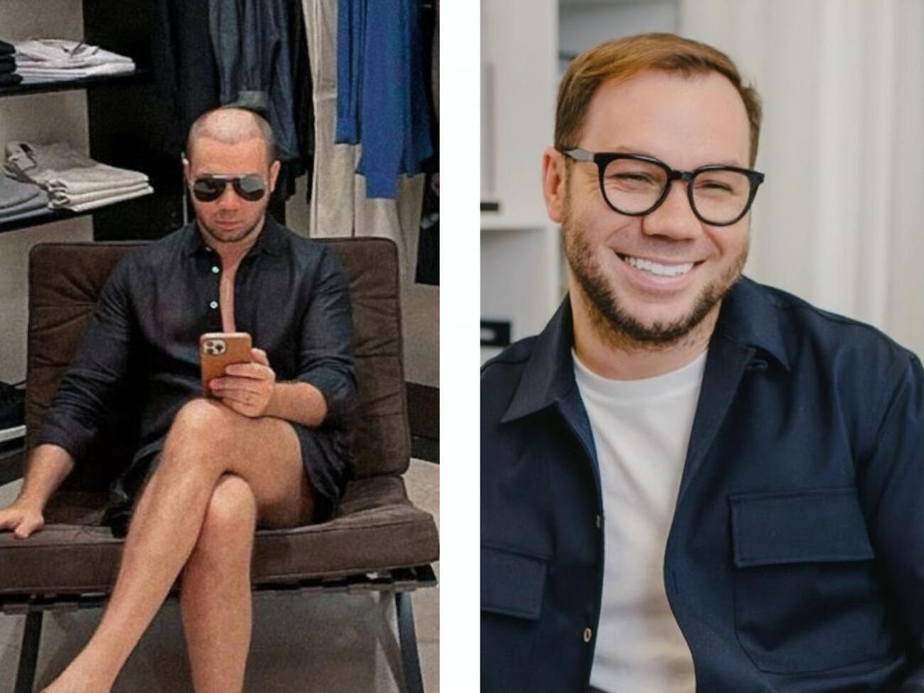 Андре Тан про пересадження волосся: Я після розлучення зробив те, на що ніколи в житті не наважувався