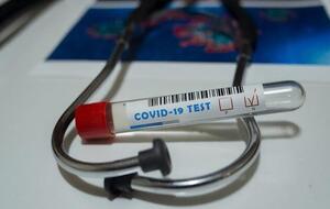 С начала эпидемии в Украине сделали почти 17,6 млн ПЦР-тестов на коронавирус