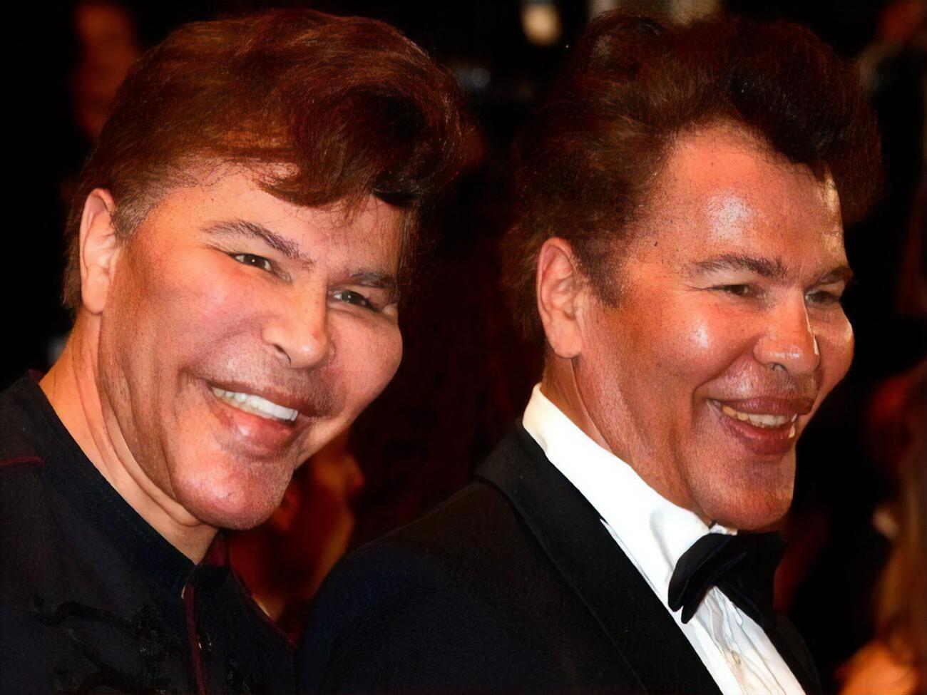 Григорій Богданов (праворуч) та Ігор Богданов (ліворуч) заперечували факт втручання пластичної хірургії у свою зовнішність