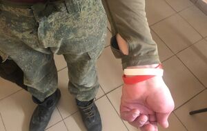 Больных боевиков помечают специальными браслетами