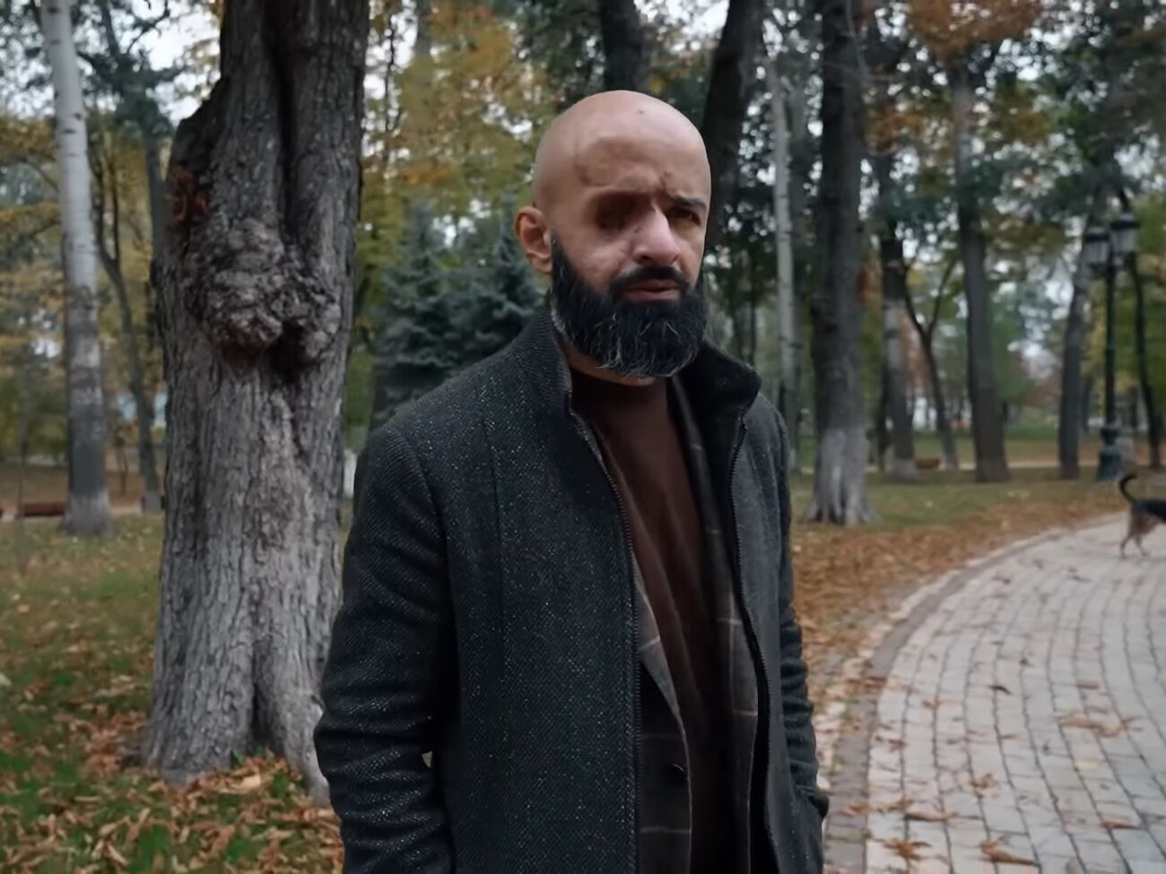 Найем:&nbsp;Очень интересный момент был: я выехал на коляске, медсестра меня везла. И я увидел впервые, что люди, когда смотрят на тебя, отворачивают взгляд. Я сначала обиделся, а потом подумал: я тоже так делал