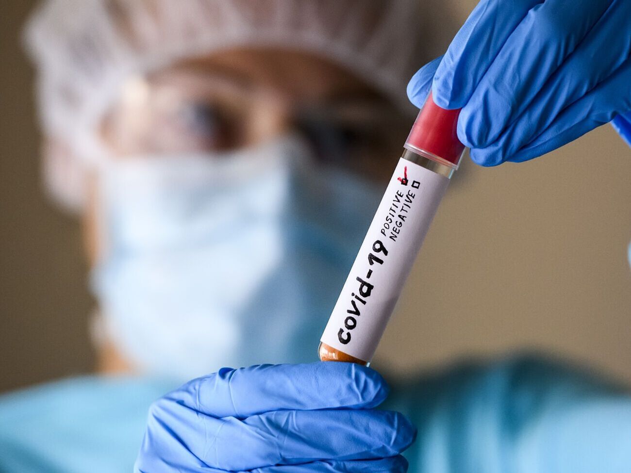 Минулого тижня ВООЗ зафіксувала трохи більше ніж 9400 смертей, пов'язаних із коронавірусом