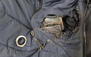 Филатов показал пальто своей подчиненной, которая пострадала от осколка российской ракеты и госпитализирована на операцию