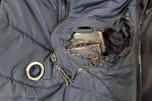 Філатов показав пальто своєї підлеглої, яка постраждала від уламка російської ракети, її шпиталізували на операцію