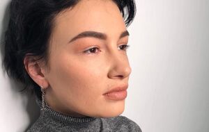 Приходько принимала участие в "Евровидении" в 2009 году, выступая от РФ