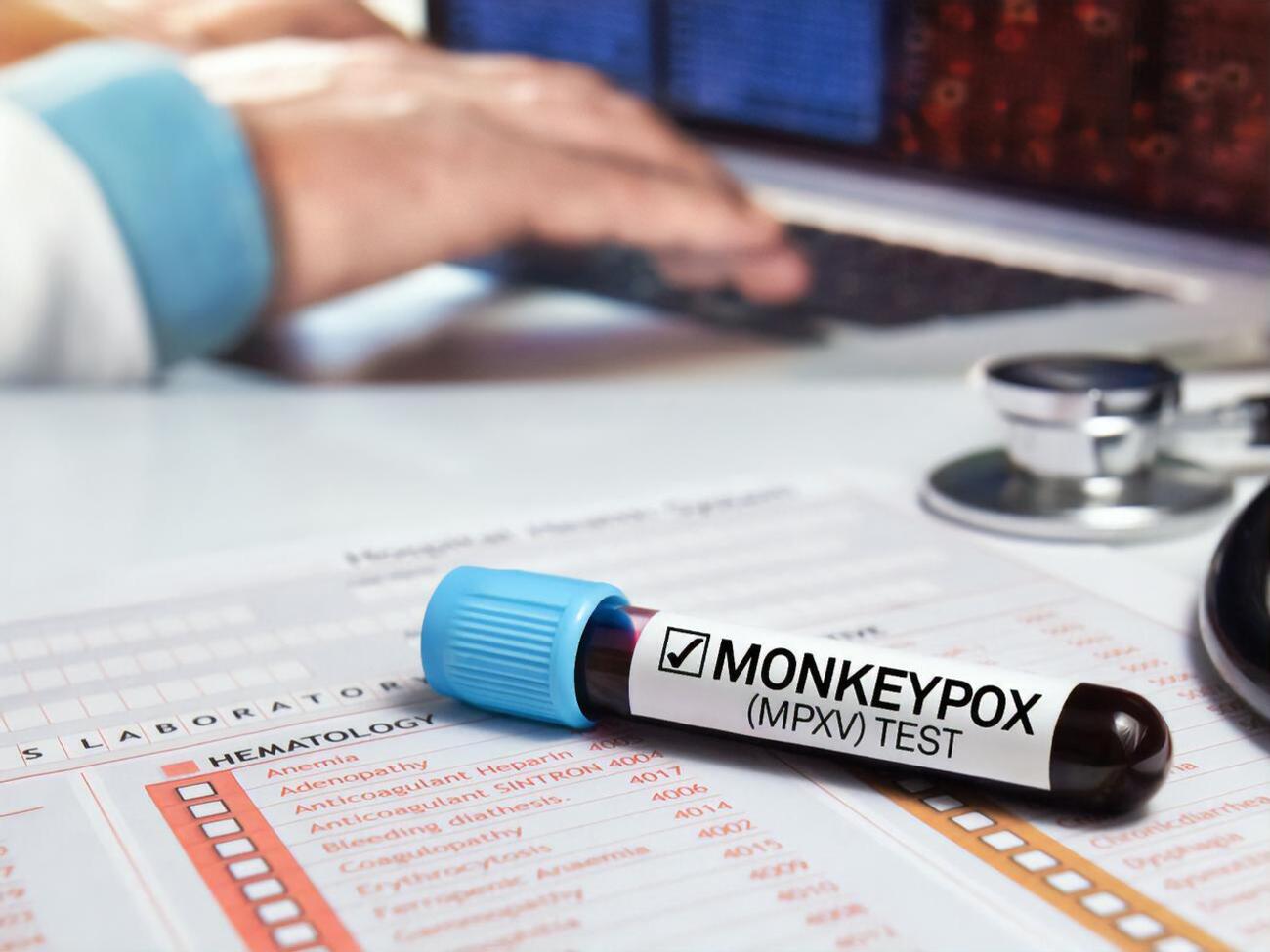 Замість&nbsp;monkeypox захворювання тепер офіційно називають mpox