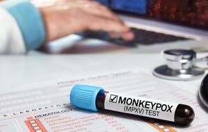 Замість monkeypox захворювання тепер офіційно називають mpox