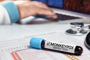 Вместо monkeypox заболевание теперь официально называется mpox