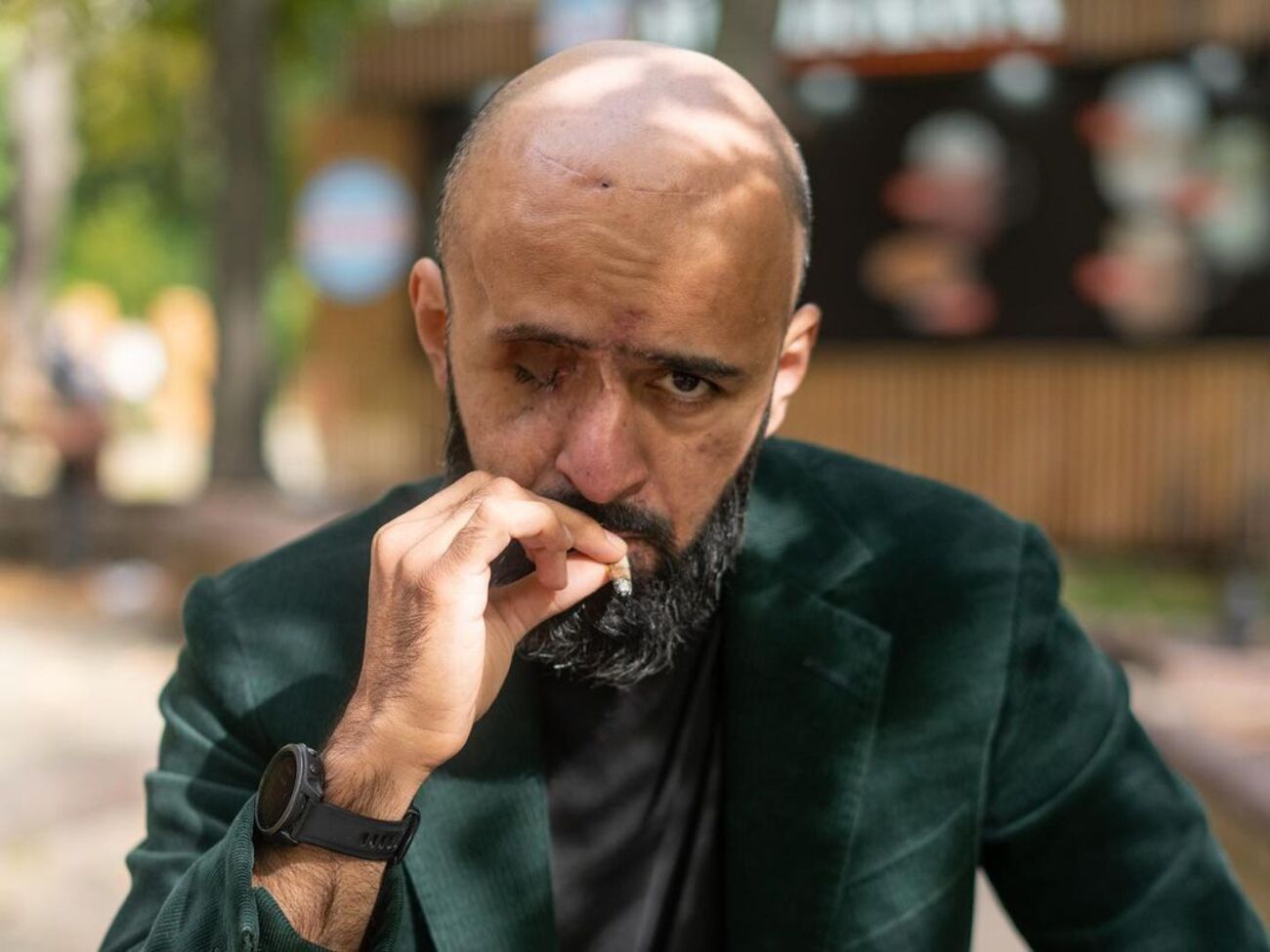 Масі Найєм підкреслив, що остаточно усвідомив те, що сталося, коли повернувся додому з клініки і "почав жити своє життя"