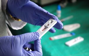 На начало 2022 года в Украине проживало 244 877 человек с ВИЧ