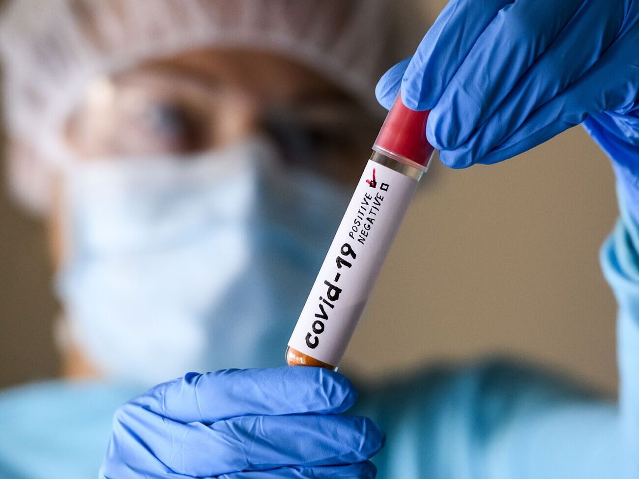 Эпидемиологи не ожидают новых штаммов коронавируса, отметил Кузин