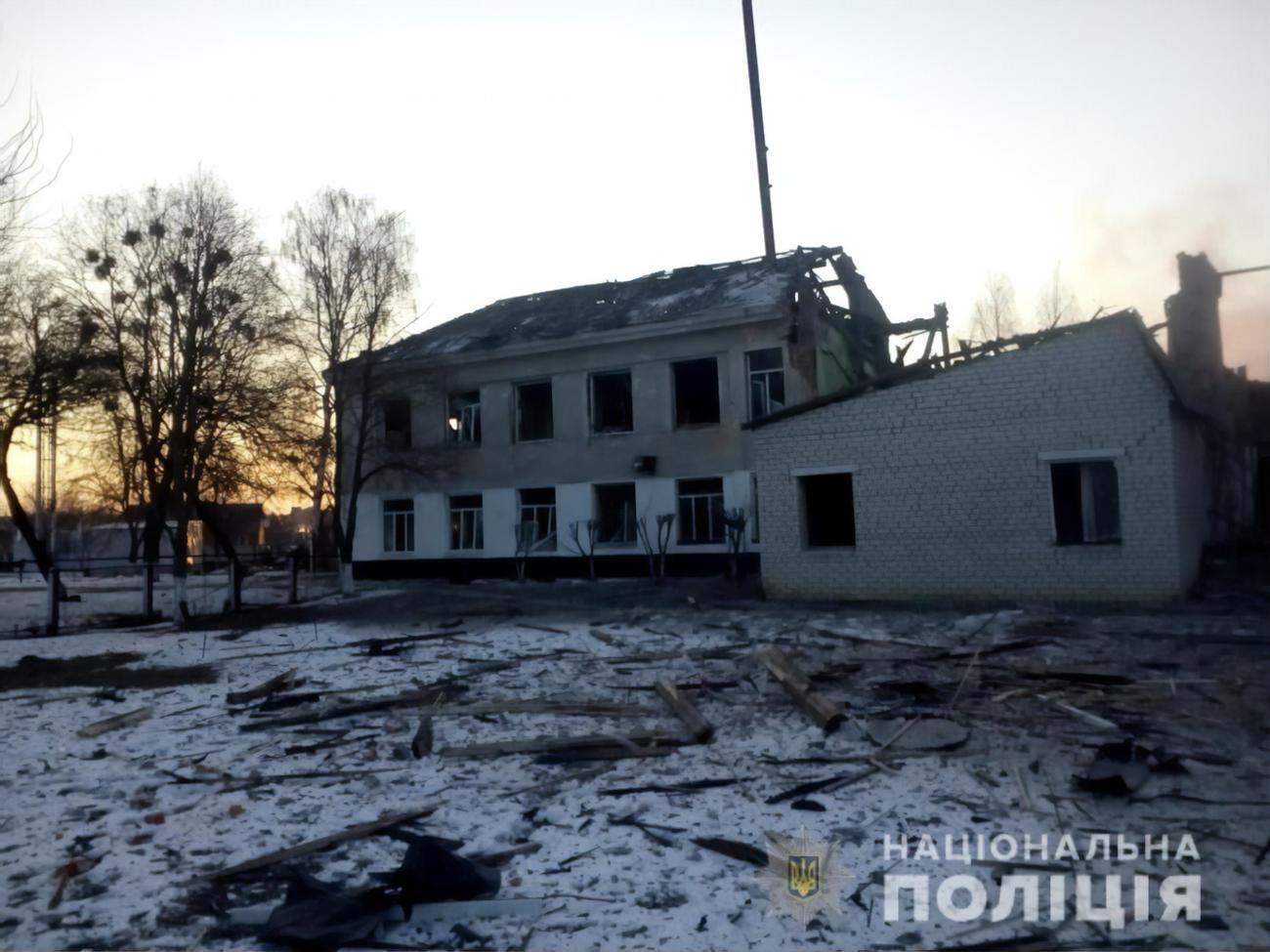 Ребенок в результате обстрела получил ранения