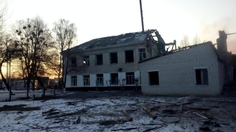 Ребенок в результате обстрела получил ранения