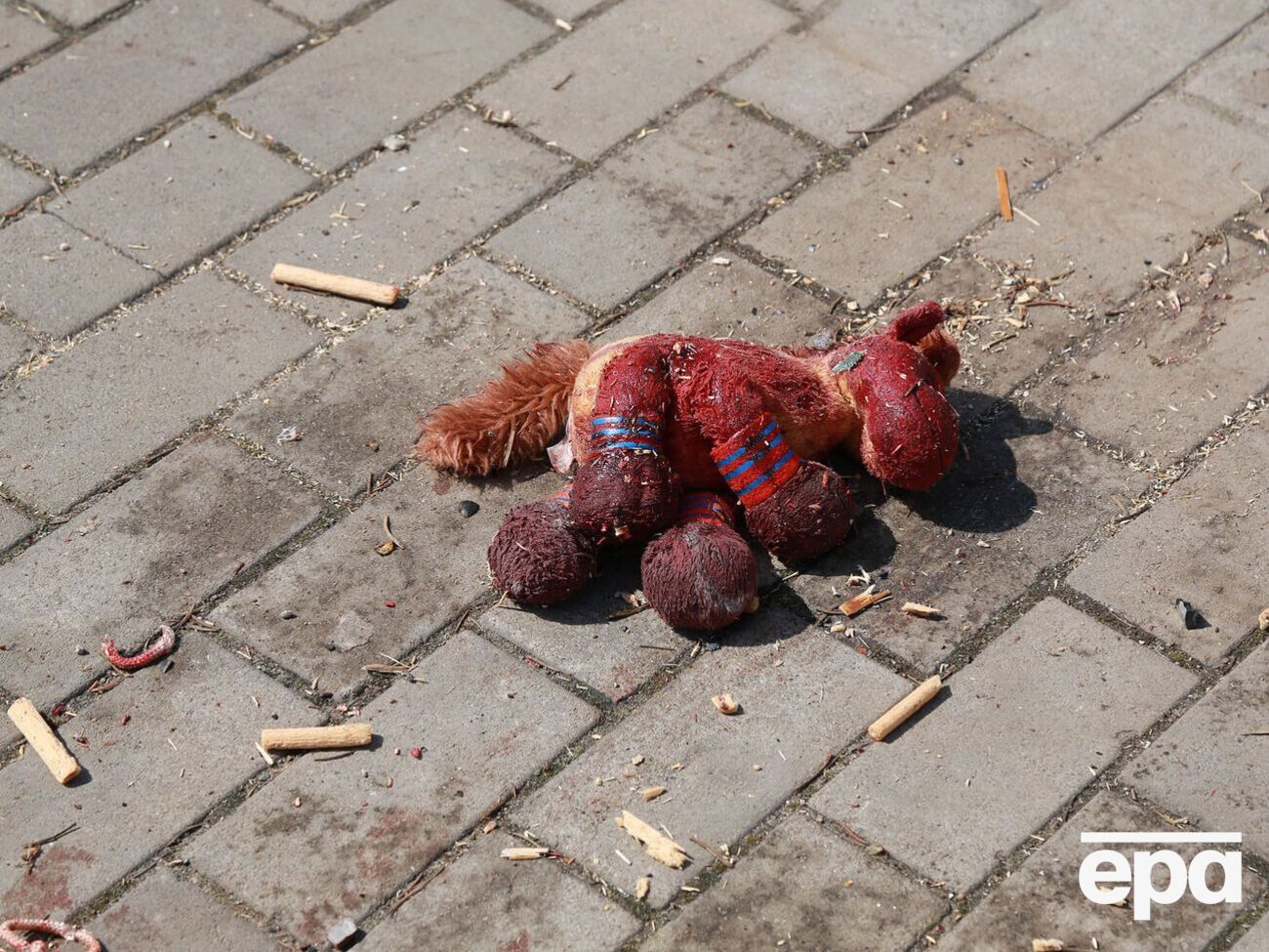 336 дітей дістали поранення за час війни