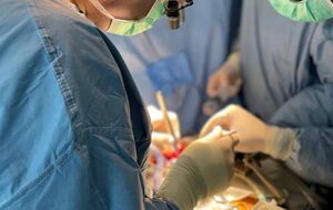 Операцию проводили на работающем сердце, она продолжалась пять часов