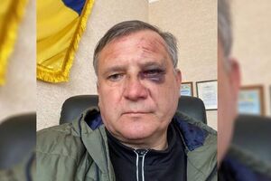 Красковского избивали в плену и выпытывали данные о ВСУ