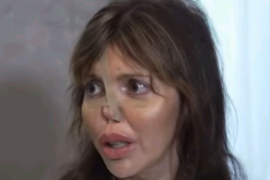 Аршавина страдает от тяжелой болезни