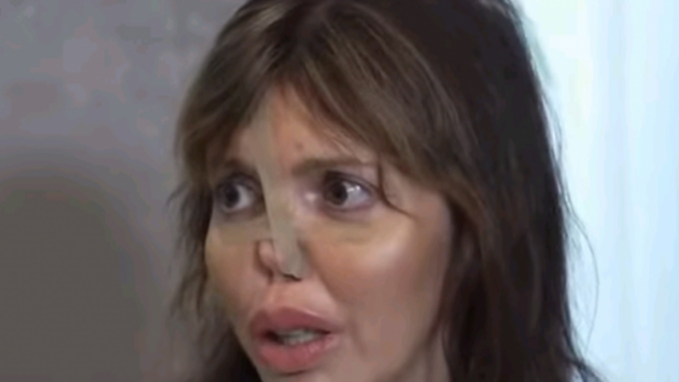 Аршавина страдает от тяжелой болезни