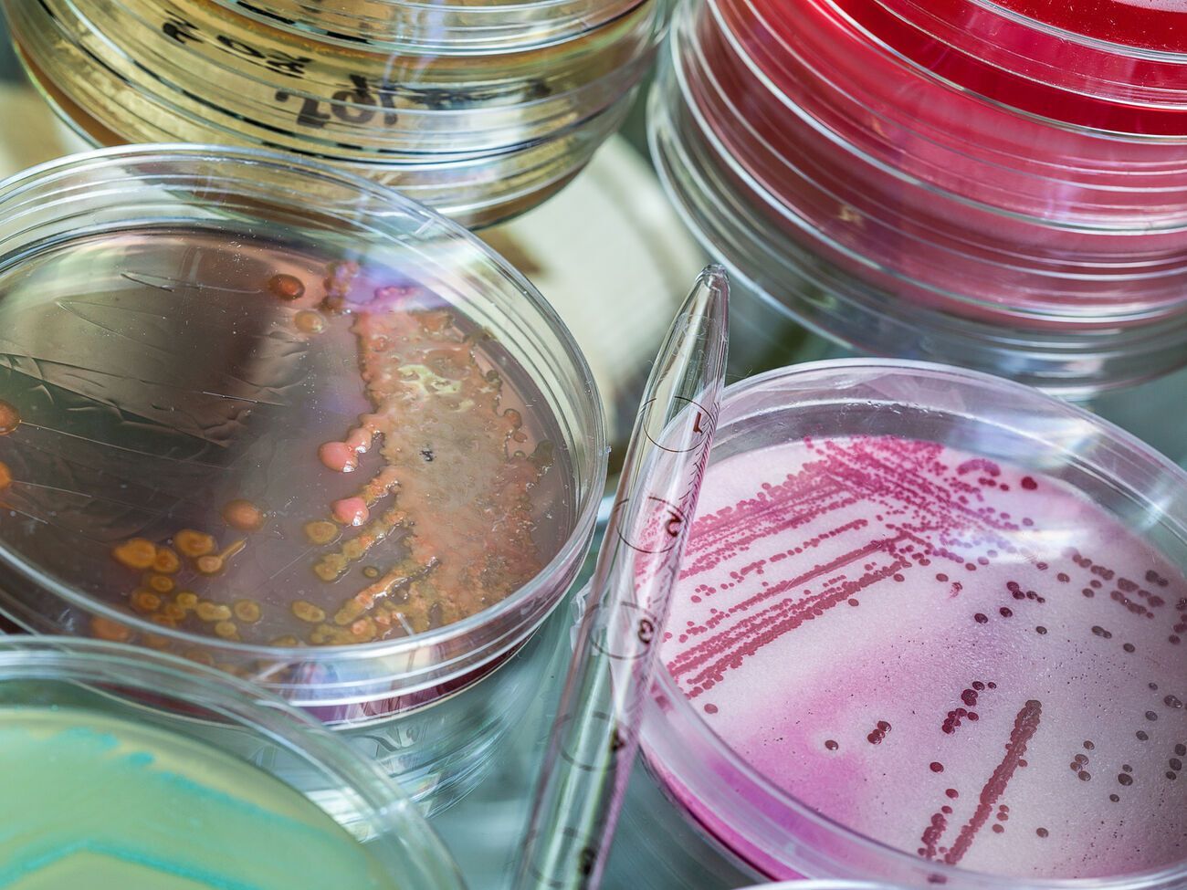 Россия может попытаться обвинить Украину в&nbsp;"применении биологического оружия", считают в ГУР