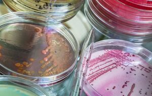 Россия может попытаться обвинить Украину в "применении биологического оружия", считают в ГУР