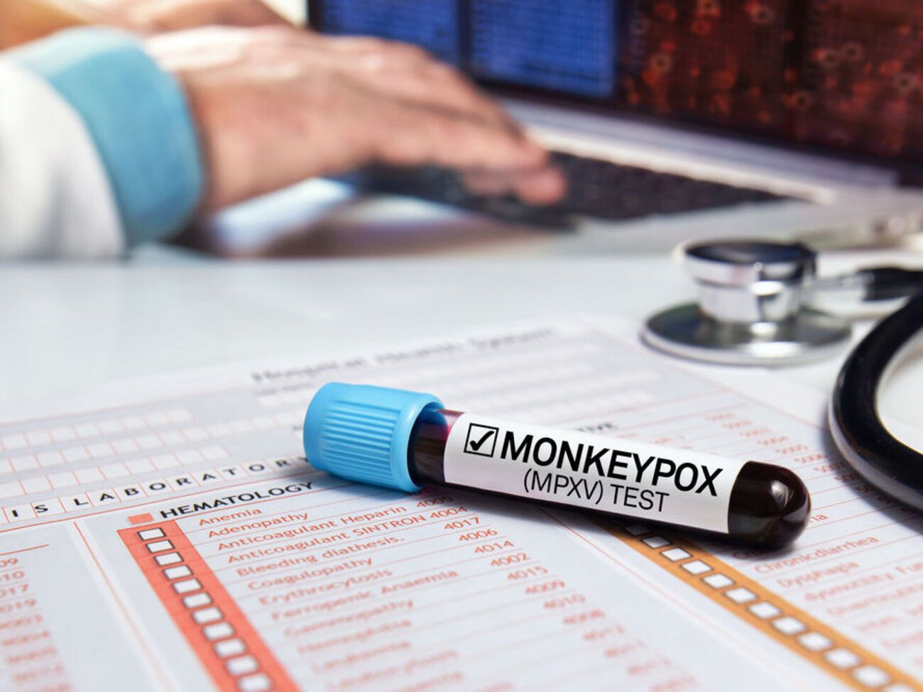 Назву "віспа мавп" експерти-медики назвали неточною та дискримінаційною