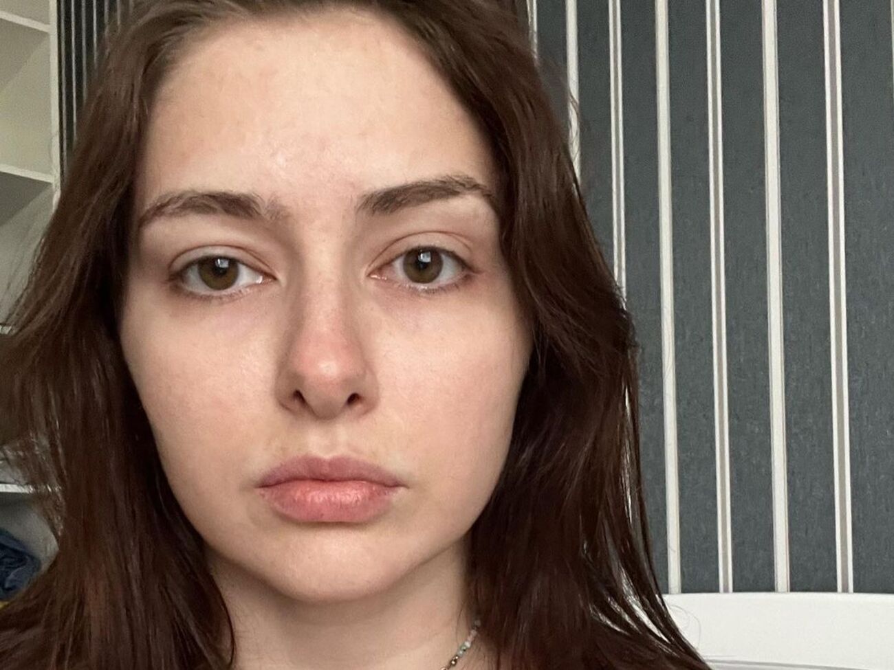 Тишкевич: МРТ показала динаміку змін у мозку