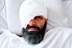 Впереди долгие дни адаптации к новой реальности. Но пока все друзья ведут себя так, будто без глаза я выгляжу лучше