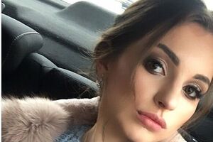 Дочка Кузьми працює лікарем-косметологом