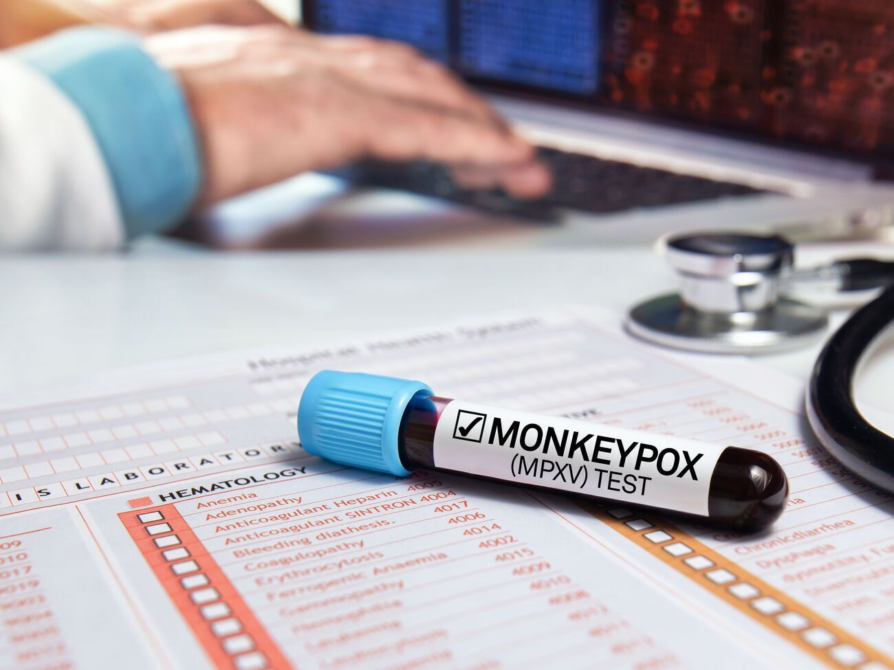 У США зафіксовано перший випадок смерті від віспи мавп