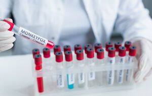 Віспу мавп у пацієнта підтвердили за допомогою ПЛР-тесту