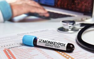 Пацієнт повідомив, що висип у нього з'явився наприкінці серпня