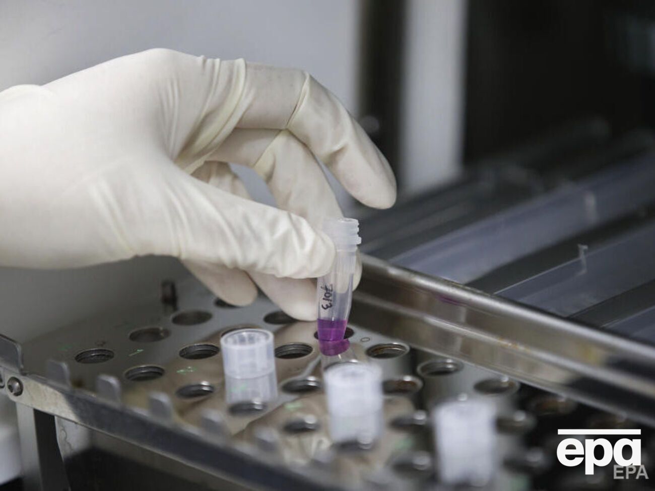 Перший випадок віспи мавп в Україні підтвердили 15 вересня