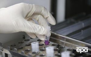 Перший випадок віспи мавп в Україні підтвердили 15 вересня