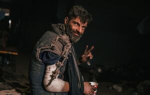 Военнослужащему нужно оперировать руку, но он настолько похудел, что сначала должен набрать вес, говорит его сестра